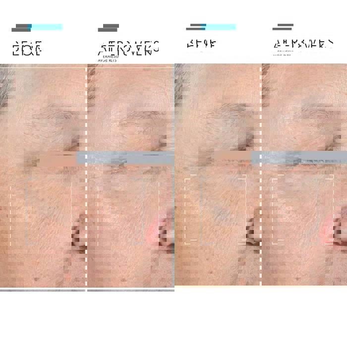 SkinCeuticals A.G.E. Advanced Eye for Dark Circles