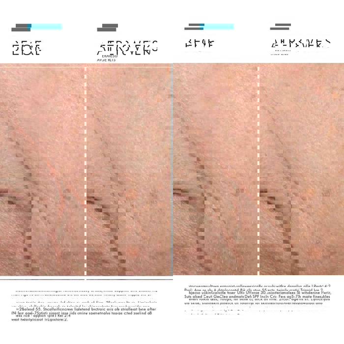 SkinCeuticals Triple Lipid Restore 2:4:2