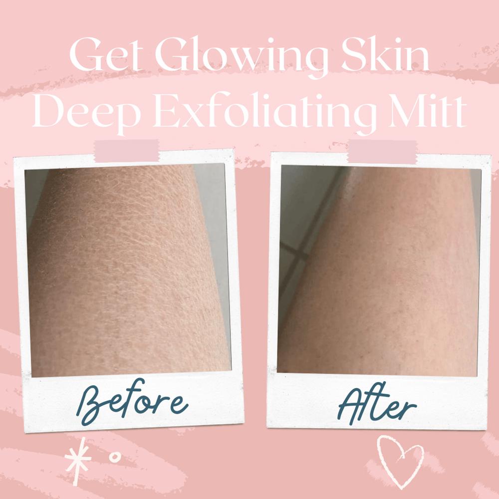 Deep Exfoliating Glove [Gently Peels Away Dead Skin]