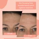  Skin Plumping Forehead Mask [Reusable]