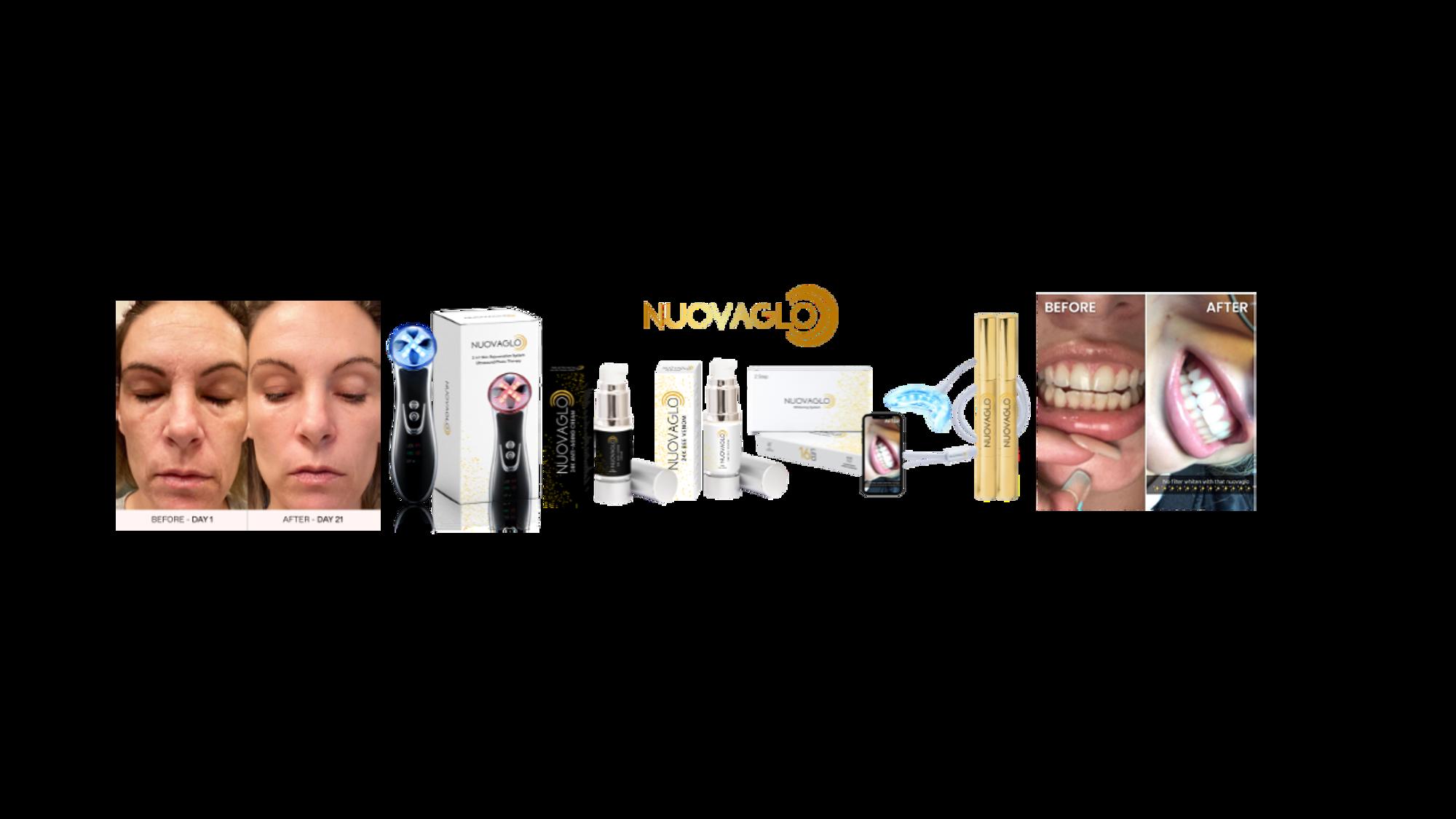 NUOVAGLO